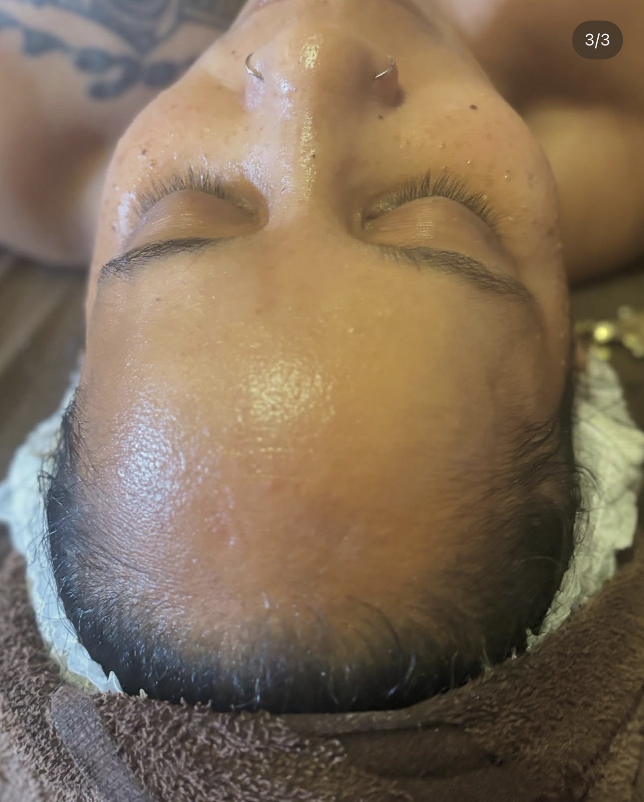 Guest skin after an anti-aging facial