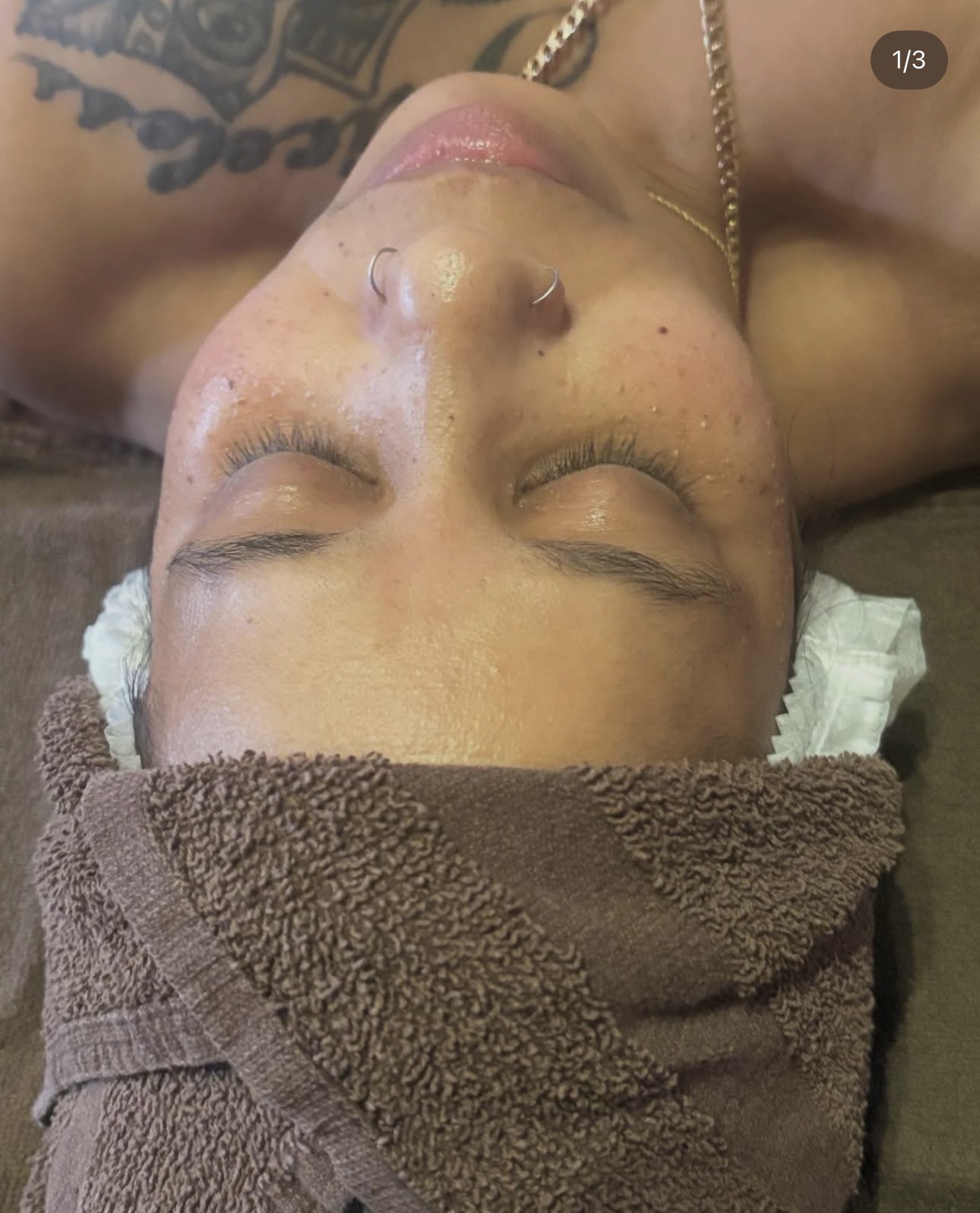 Guest skin before an anti-aging facial